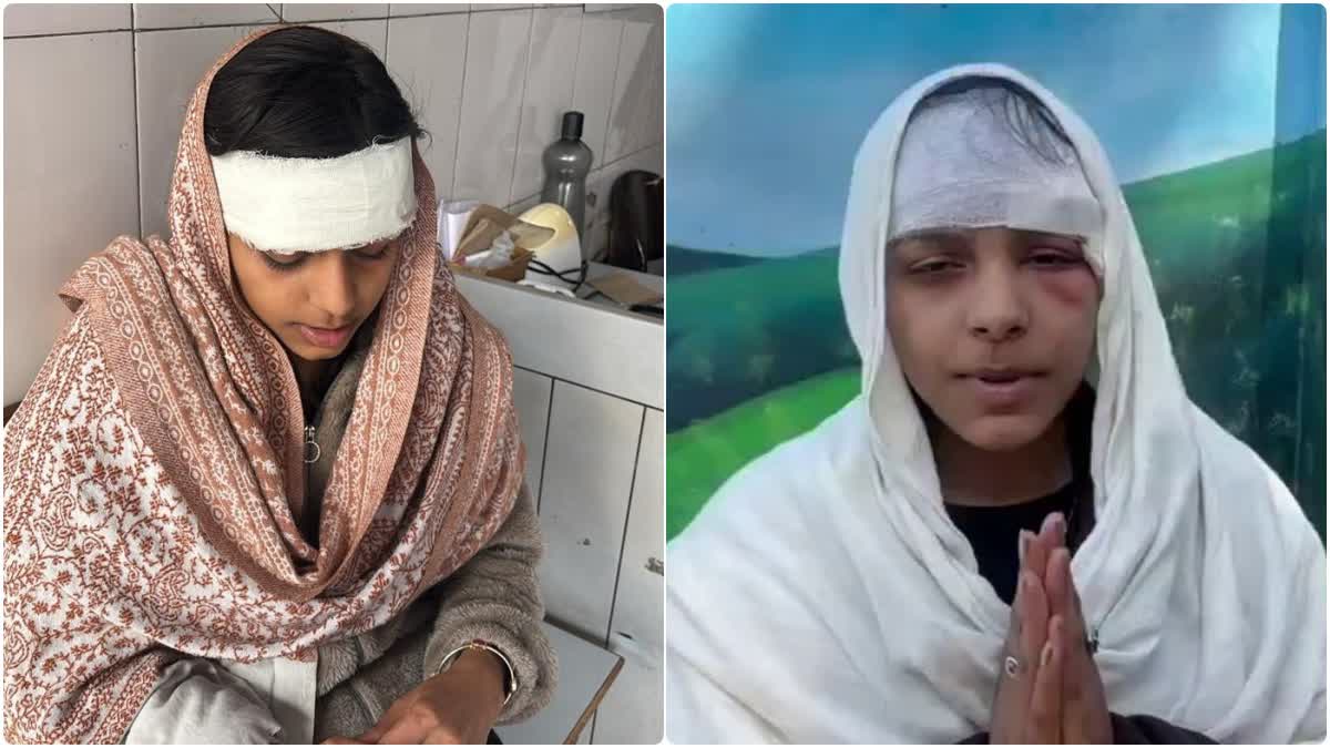 देहरादून: कैफे बर्थडे पार्टी विवाद में घायल युवती ने बताई सच्चाई, अफवाहों से किया इनकार